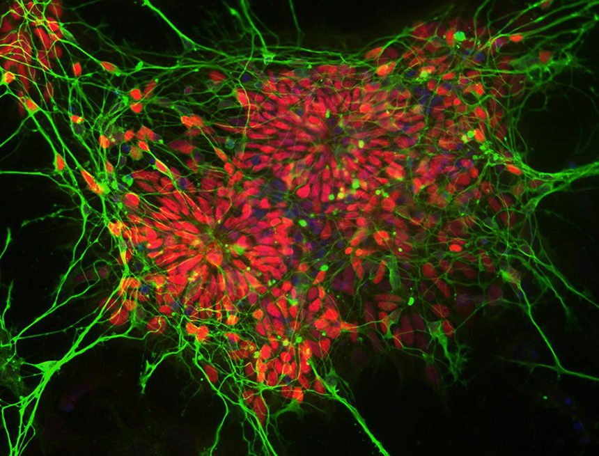 Clusters of new neurons growing in culture