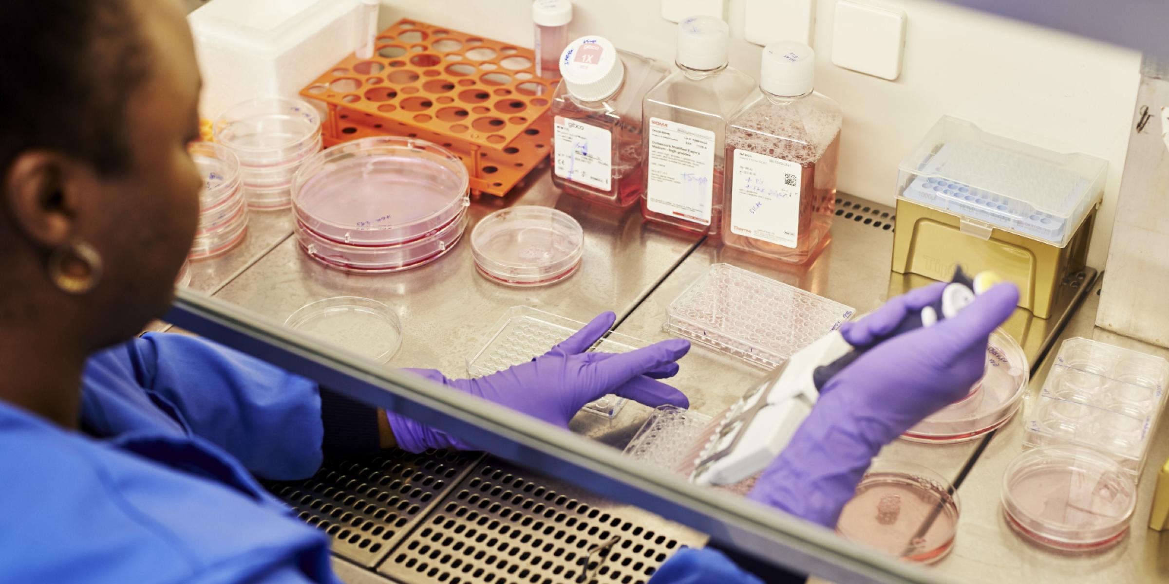  Three New Developments in Dementia Treatment Research that Happened in 2020.