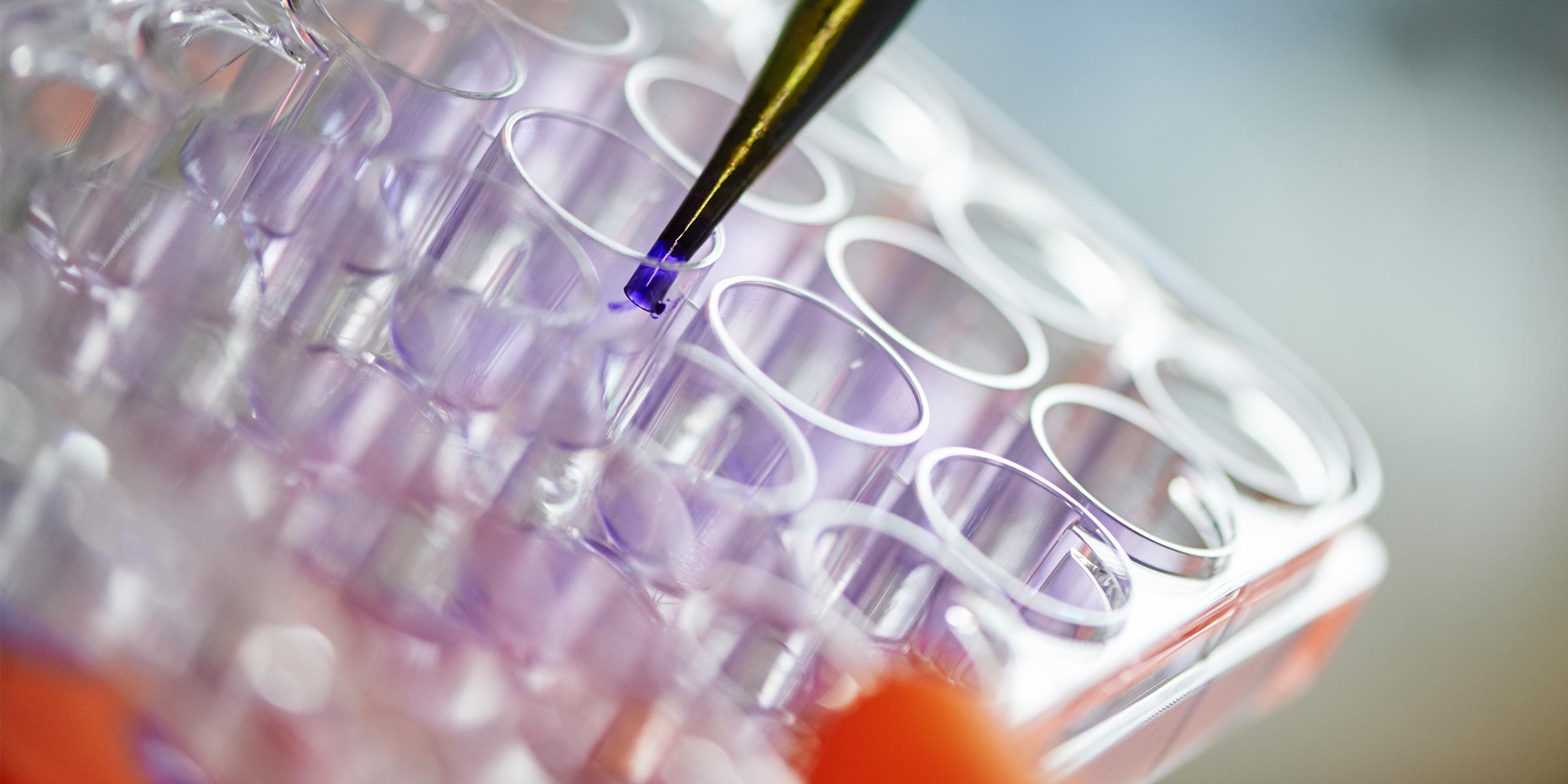 Research samples in a lab