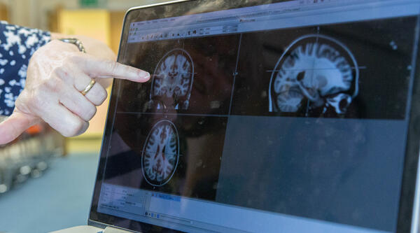 Researcher pointing at brain scan
