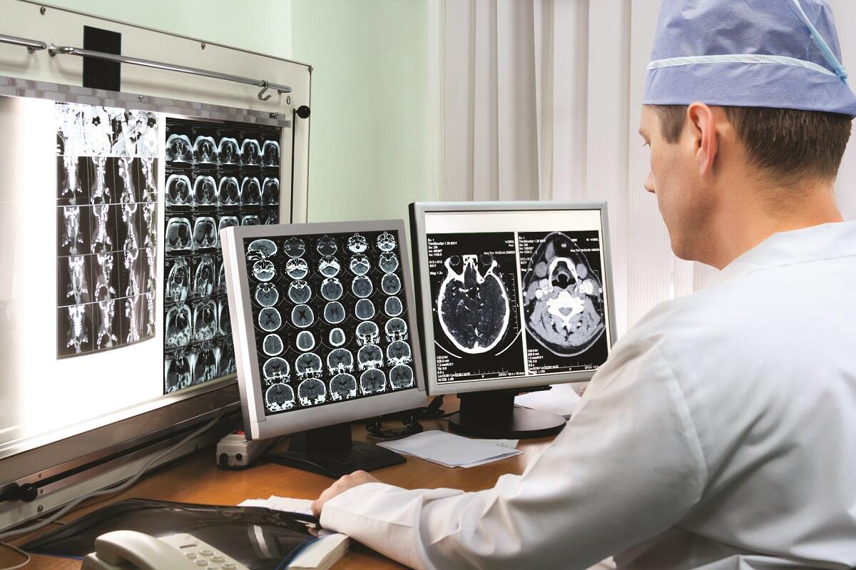 A researcher looking at brain scans