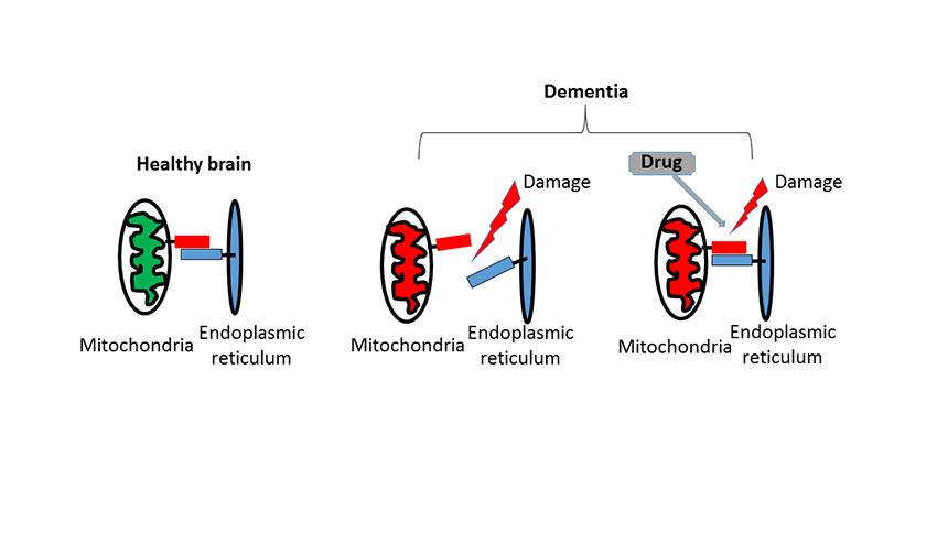 Diagram of mitochondria in a healthy brain and a brain with dementia