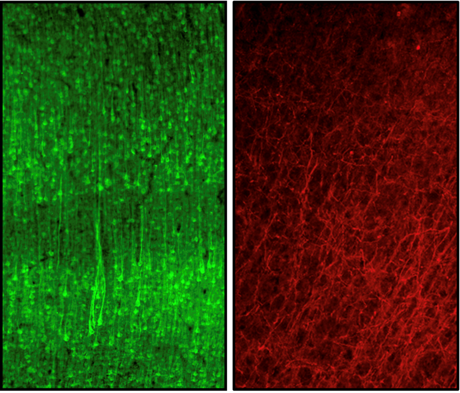 Fluorescent images of brain cells under a specialist microscope