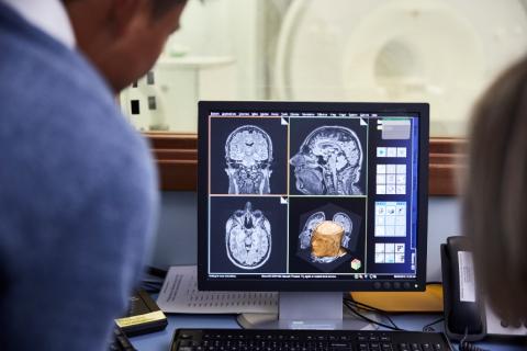 Two health professionals looking at a brain scan image